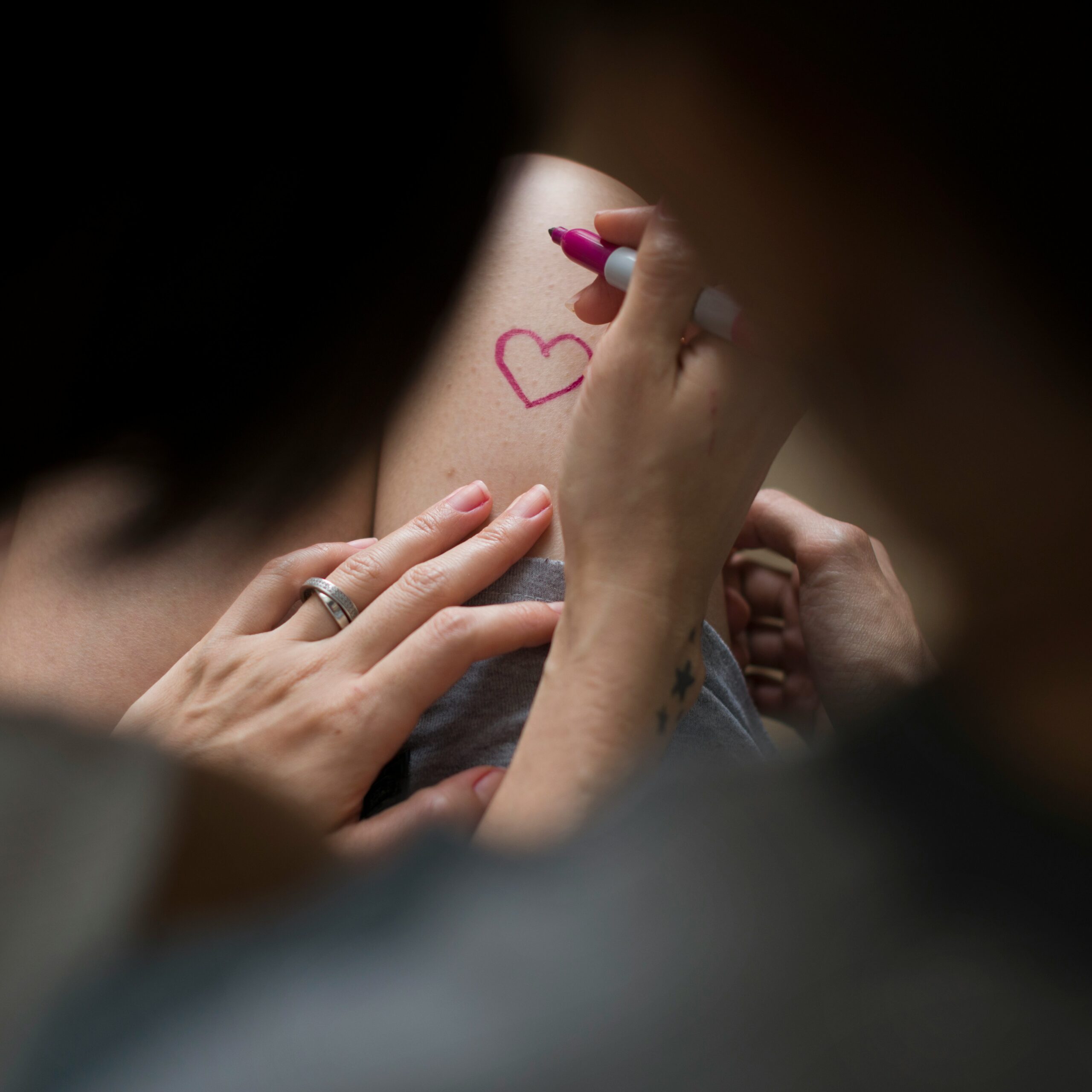 The First Days After Vaginoplasty: What Patients Experience