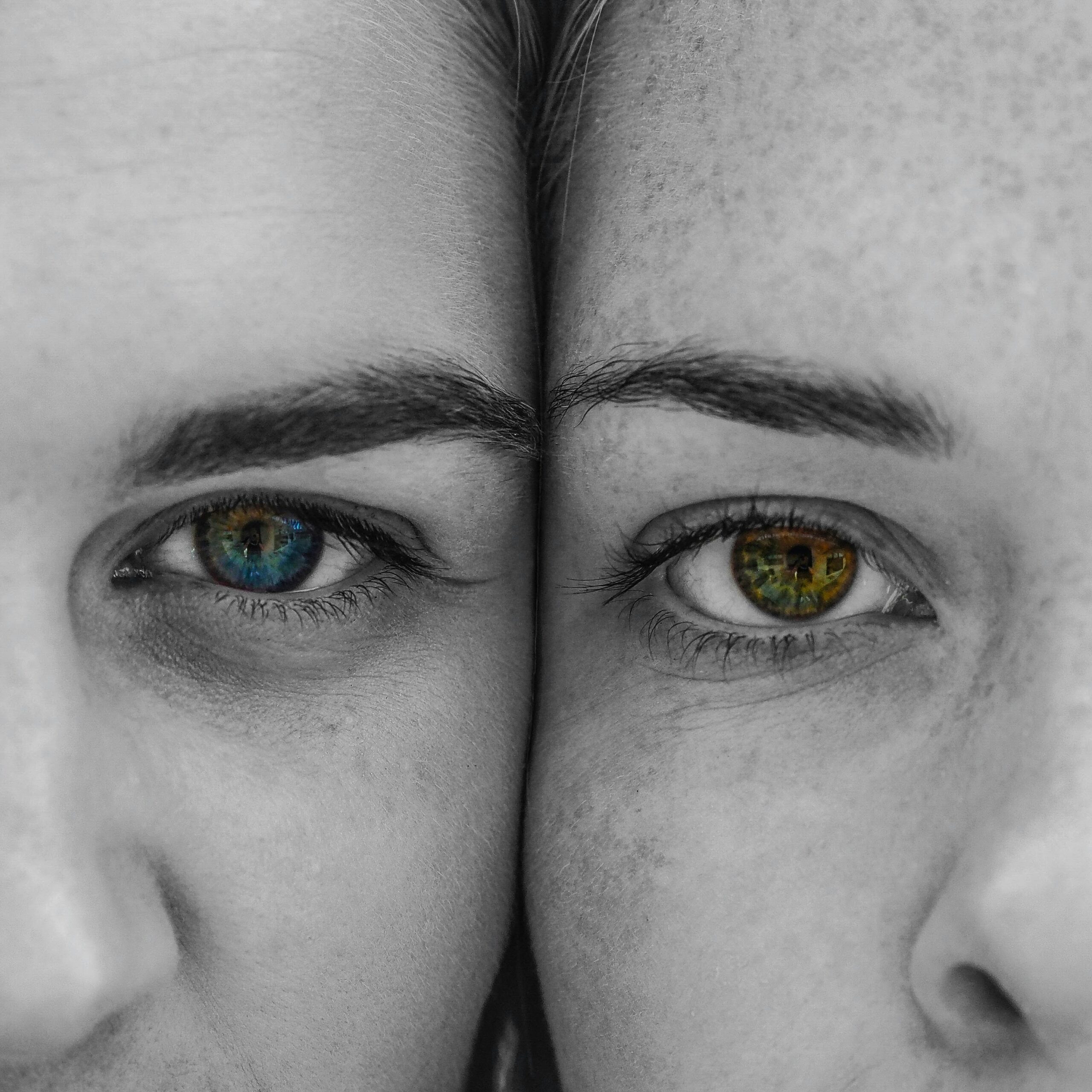 High quality and affordable Face Feminization in Spain