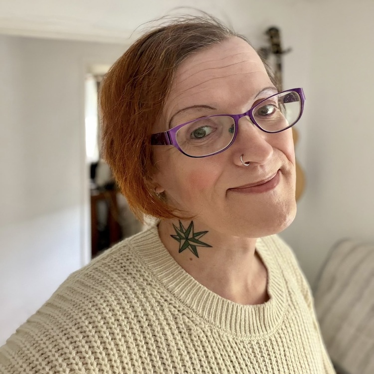 Lea´s Inspiring Genioplasty